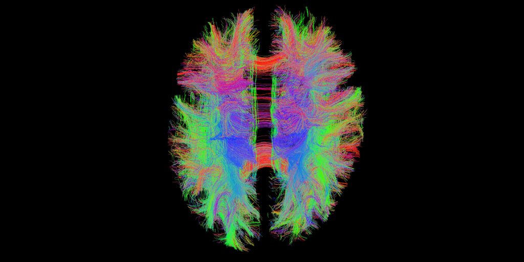 MRF-Lupus-Brain-twitter.jpg#asset:5931