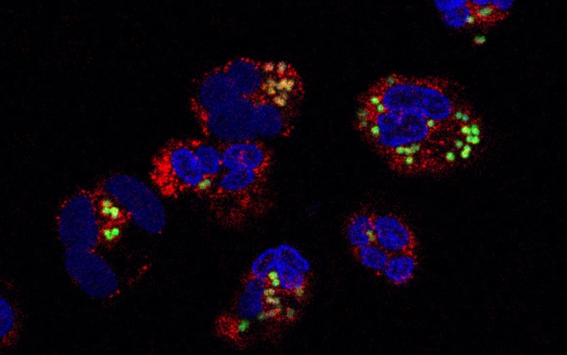 Neutrophils.png#asset:8314